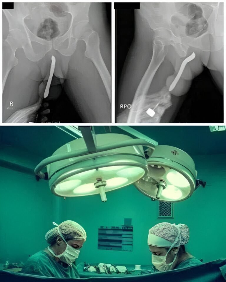 Girl had to be hospitalized for wanting to use a pe… See more3