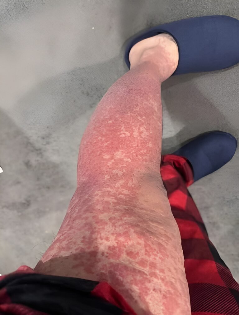 These are the consequences2