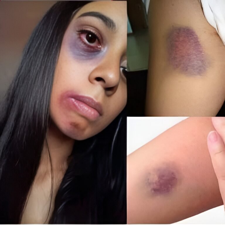 Young woman dies at the hands of her… See more2