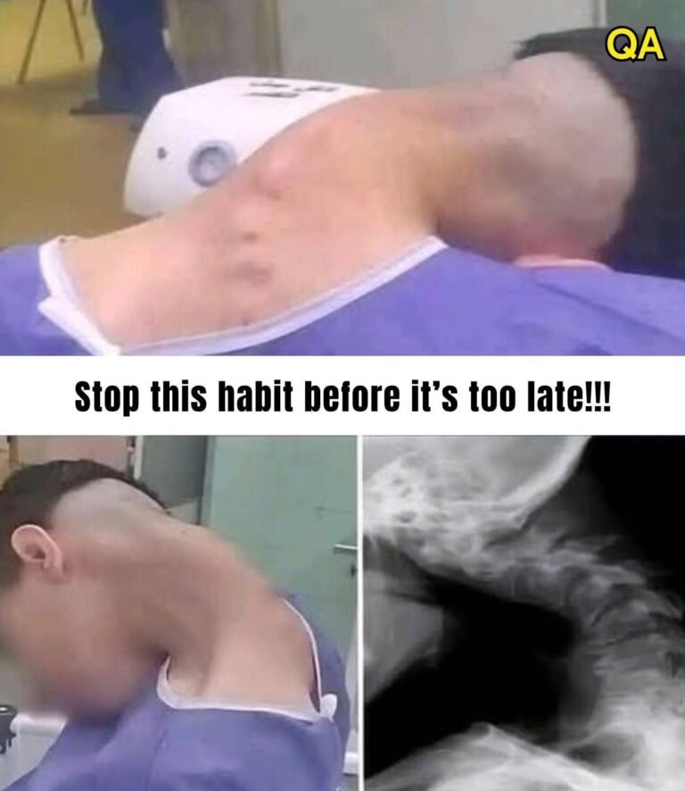 Young man hospitalized because he dropped his ca!