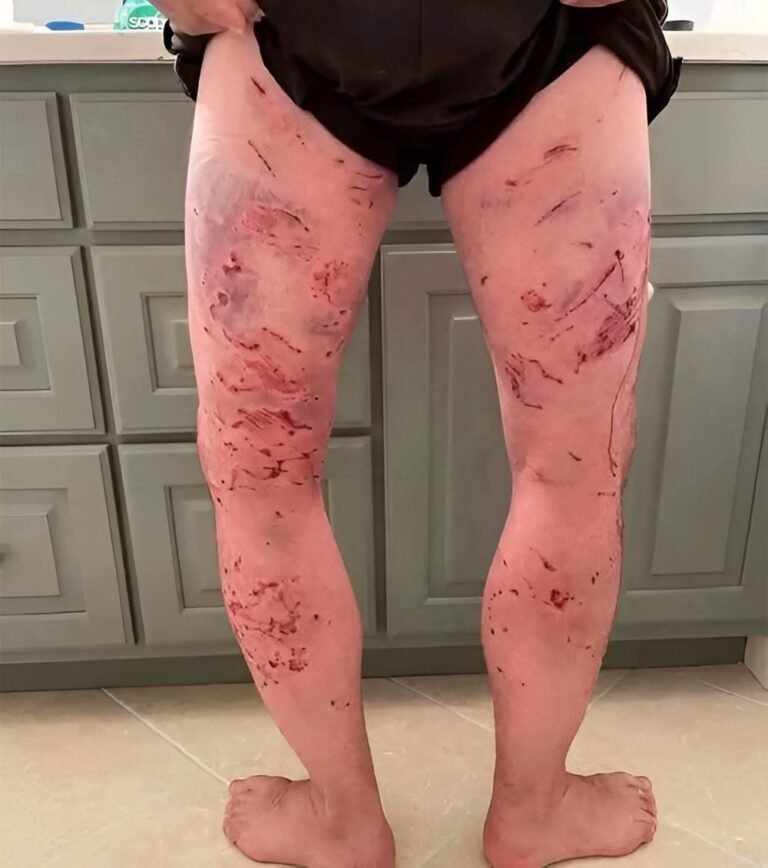 These are the consequences of sleeping with the… See more