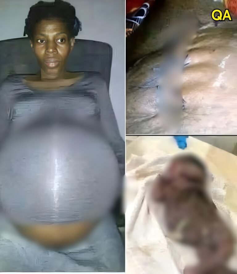 A 30-year-old woman in Georgia was declared brain dead